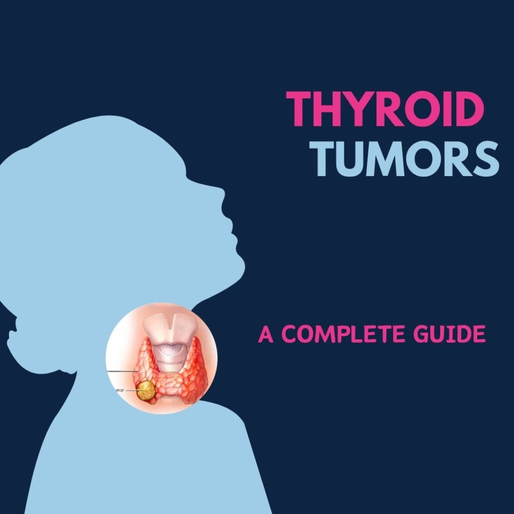 Thyroid tumors