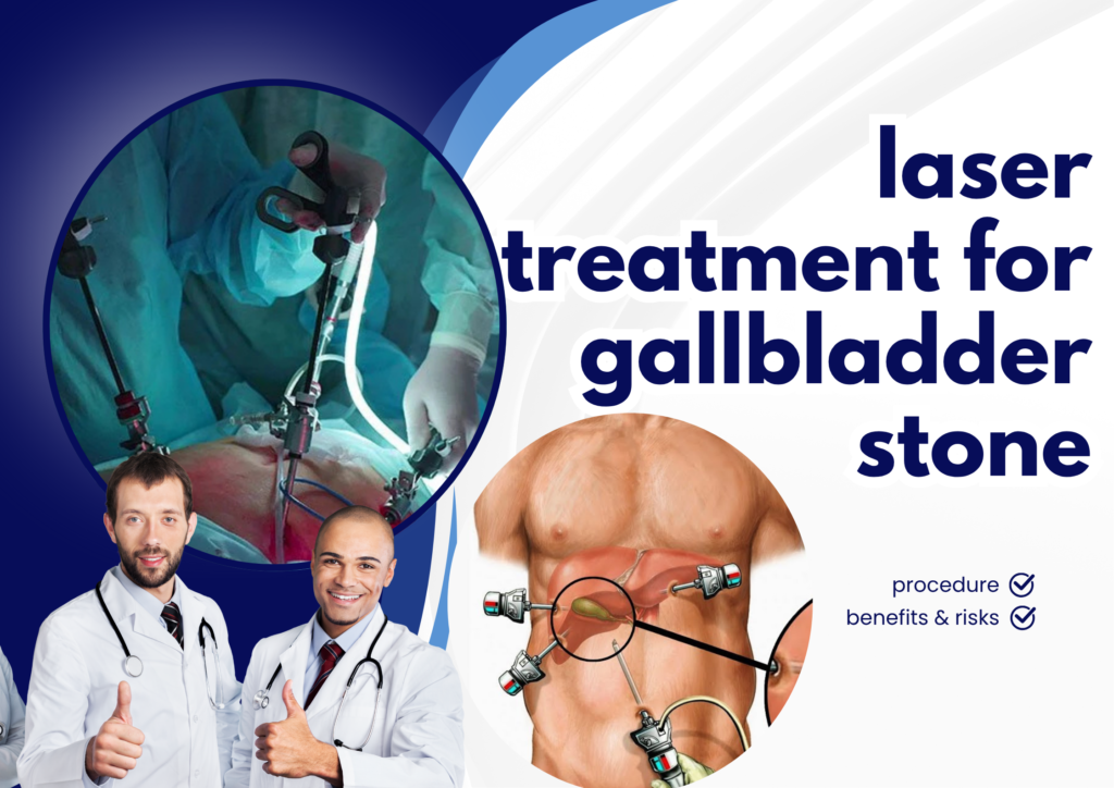 laser treatment for gallbladder stone
