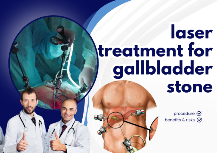 laser treatment for gallbladder stone