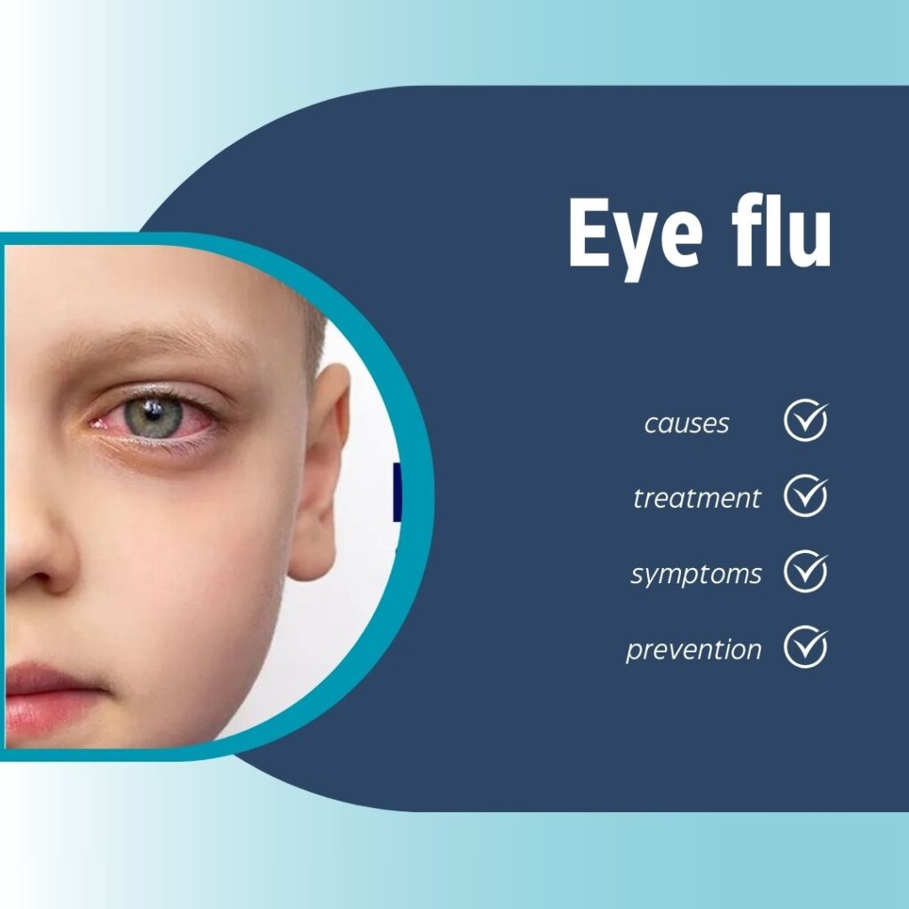 Symptoms of eye flu Symptoms of eye flu