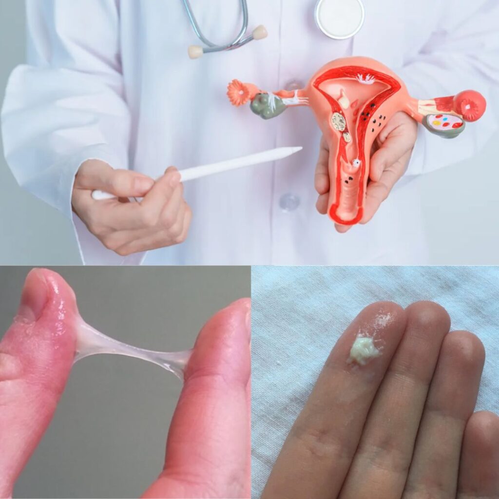 white vaginal discharge white vaginal discharge
