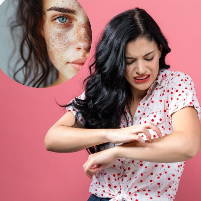 Skin allergies